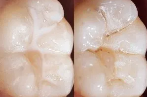 뉴코키아치과병원 이미지