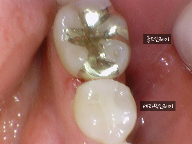청라오치과의원 이미지