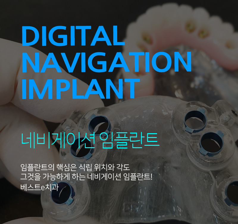 서울이튼치과 이미지