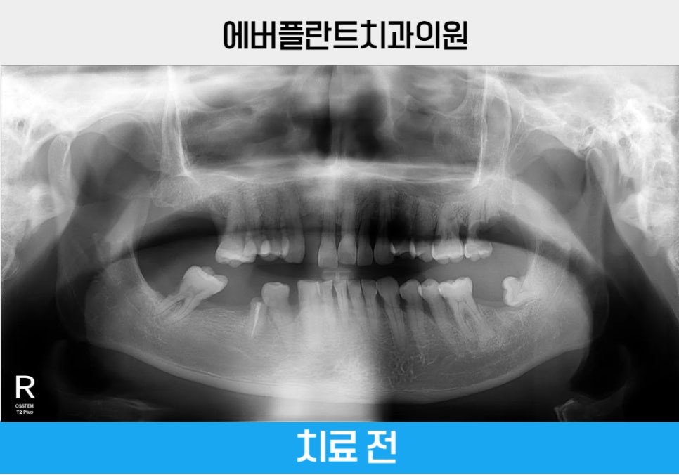 에버플란트치과의원 이미지
