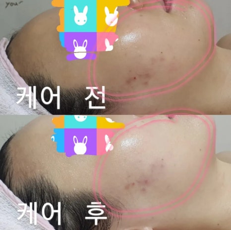 에스케어 이미지