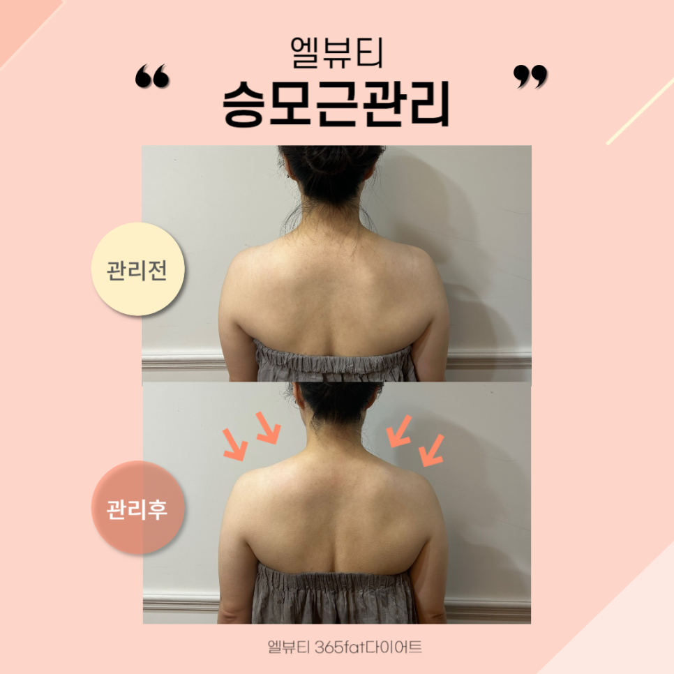 365뷰티라인 이미지