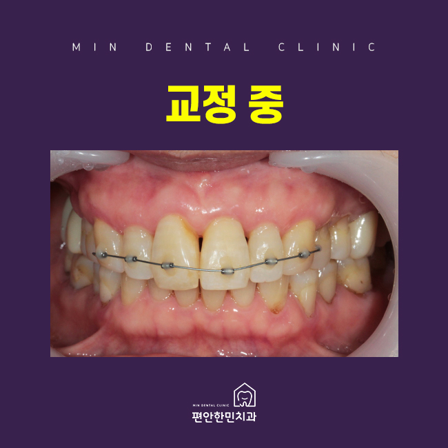 편안한민치과 이미지