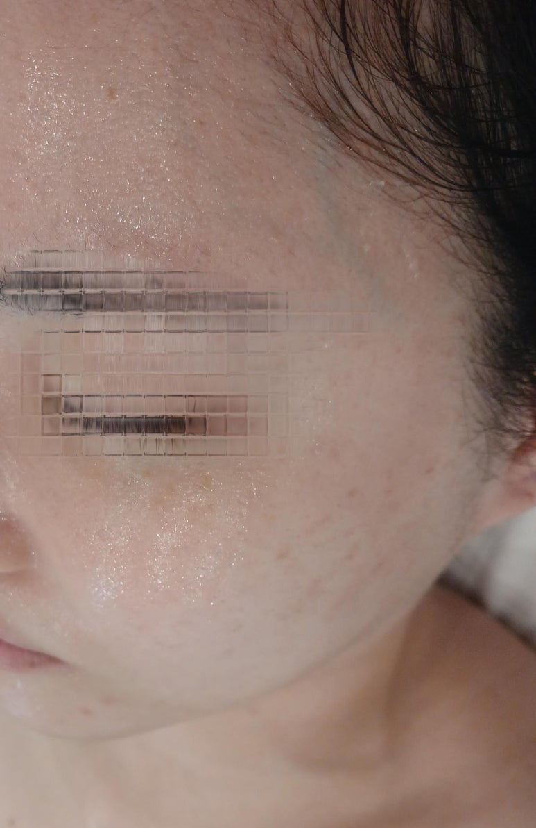 윤메디테라피 이미지