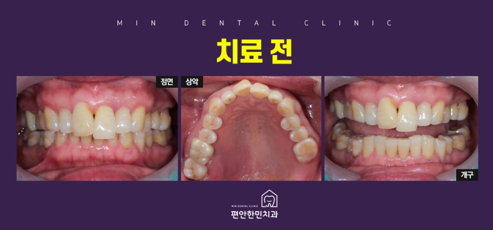 편안한민치과 이미지