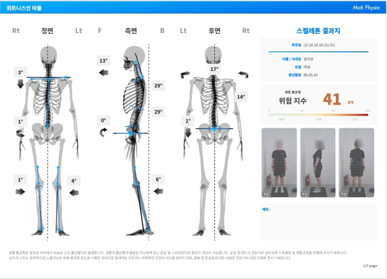 우용 이미지