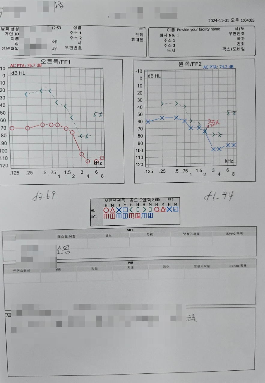 오케이 보청기 이미지