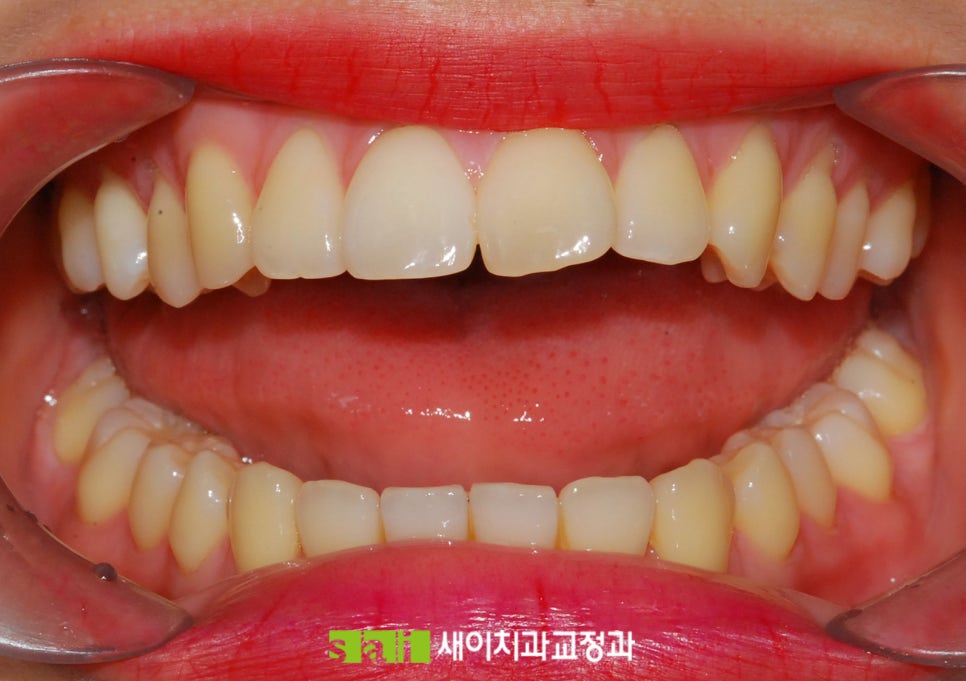 새이치과교정과치과의원 이미지