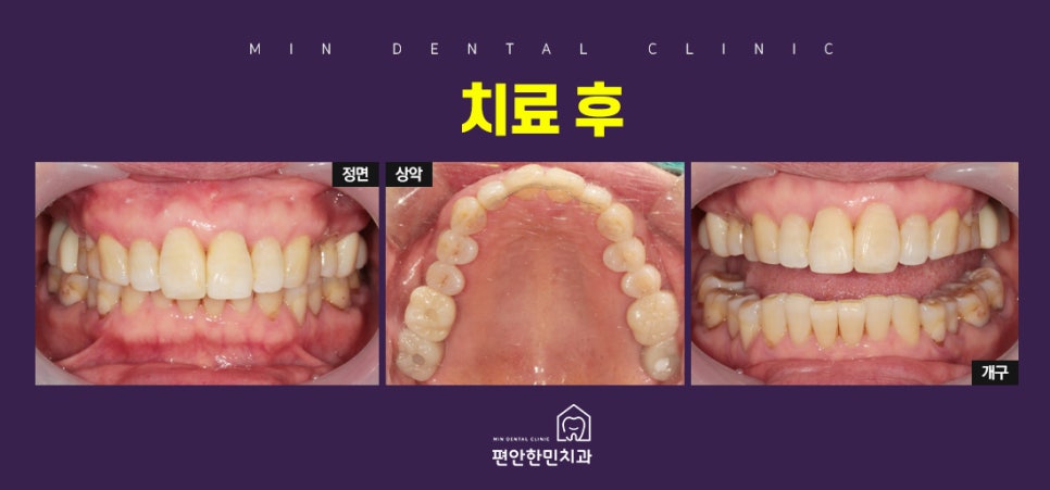 편안한민치과 이미지