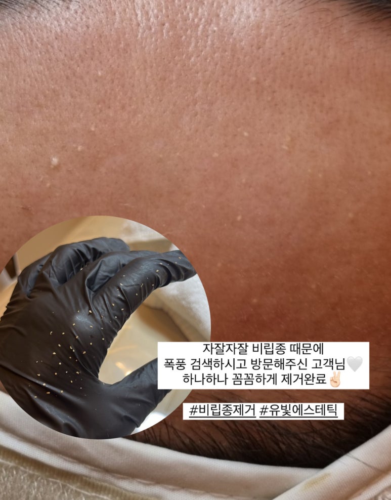 유빛 이미지