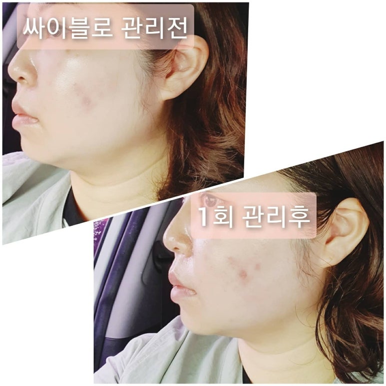강성희 스킨·바디 이미지