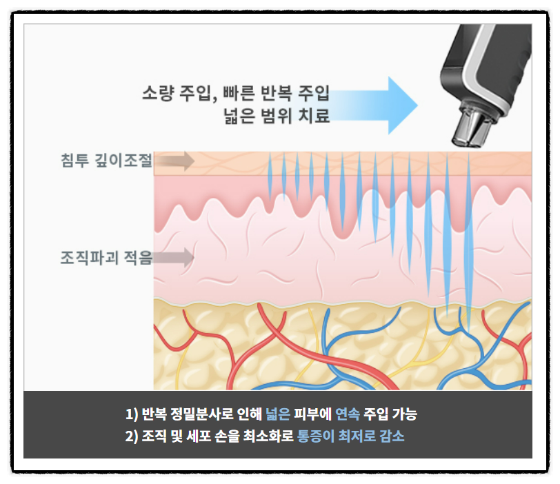젯콘트롤 이미지