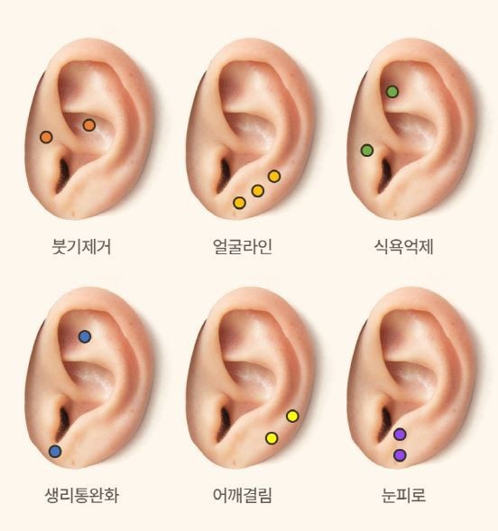 비니네일 이미지