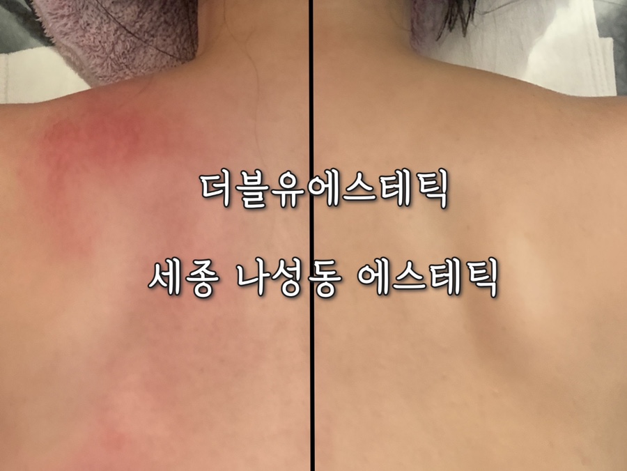 더블유에스테틱 이미지