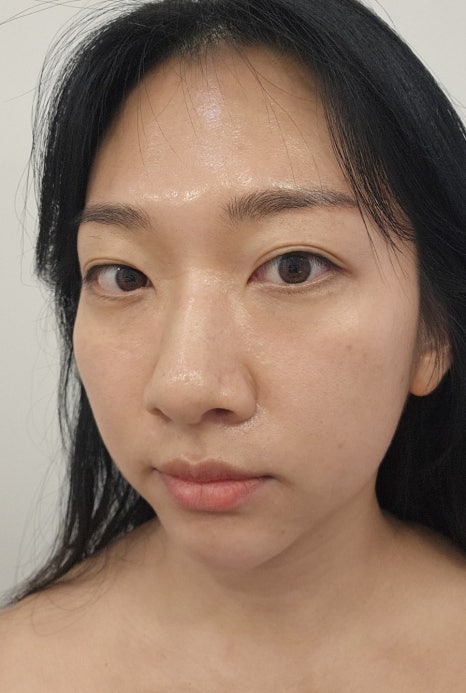 유니피부샵 이미지