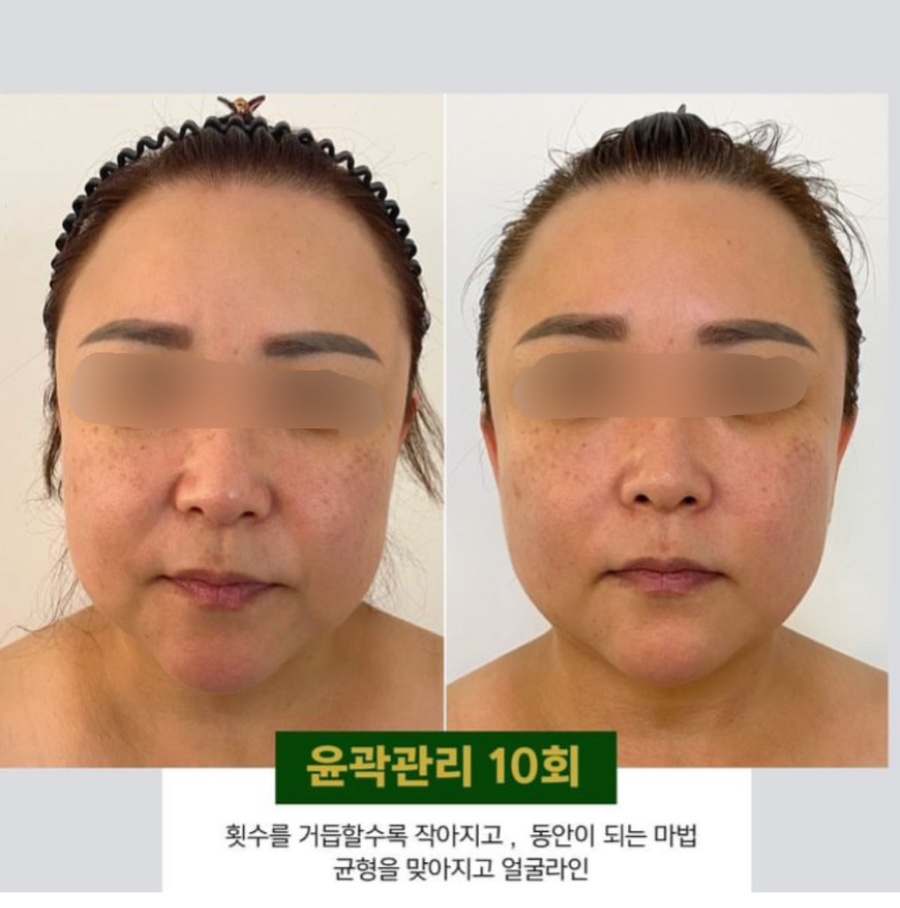 더빛나스킨케어 이미지