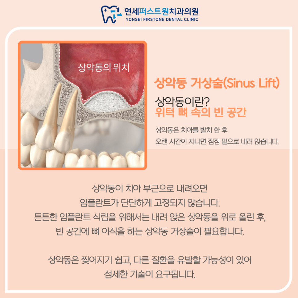 퍼스트원광고 이미지