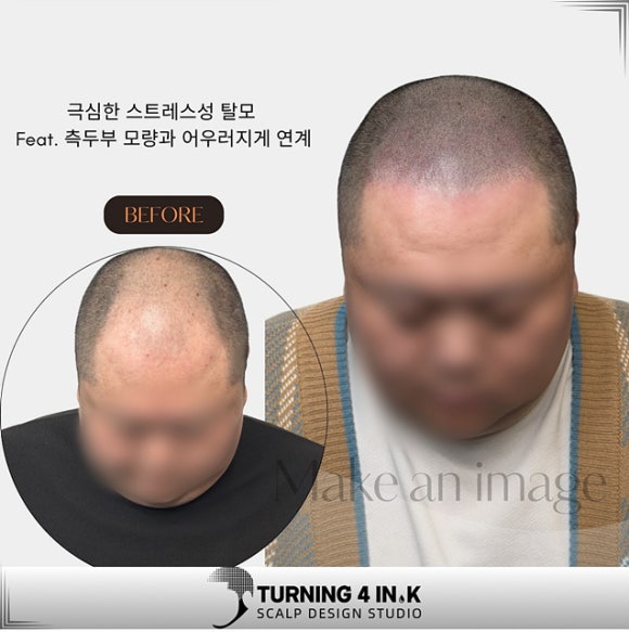 헤어휘날리기 이미지