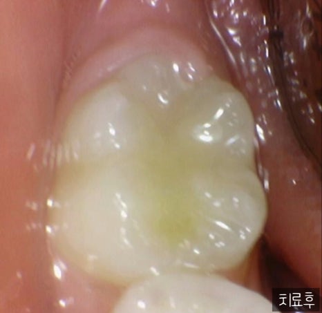 청라오치과의원 이미지