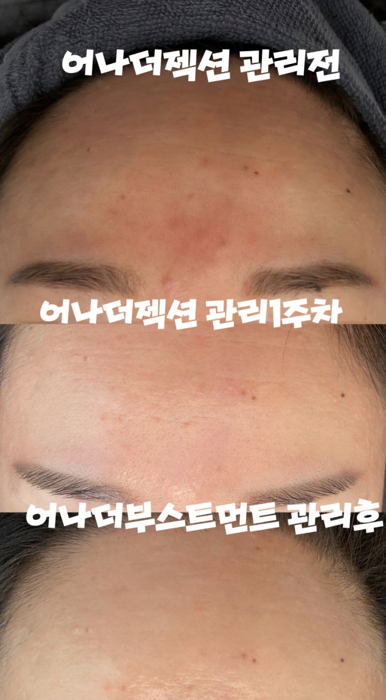 어나더 핸드 이미지
