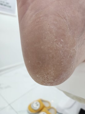 예뻐네일 이미지