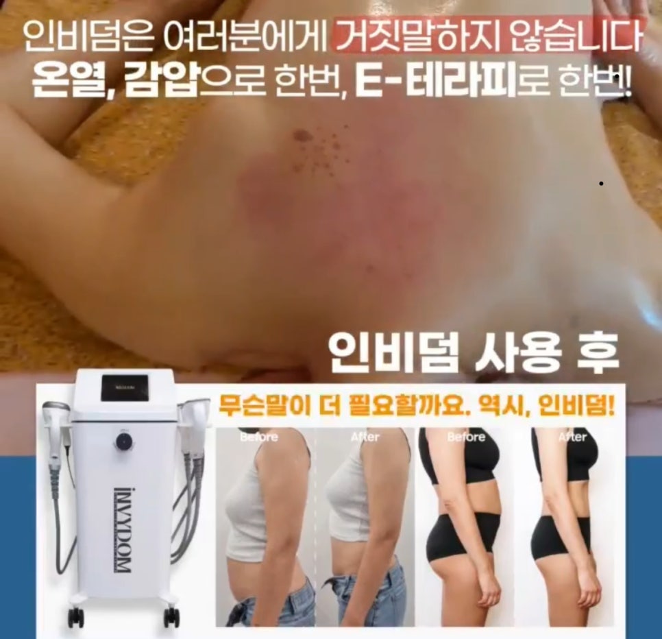 뀨니뷰티 이미지