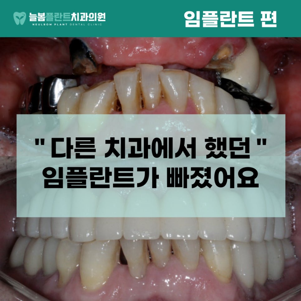 늘봄플란트치과 이미지