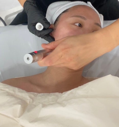 블랑드보떼 이미지