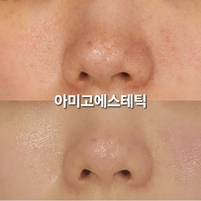 아미고에스테틱 이미지