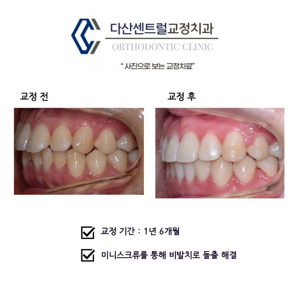 다산센트럴치과교정과치과의원 이미지