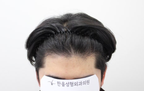 더헤어라인성형외과의원 이미지