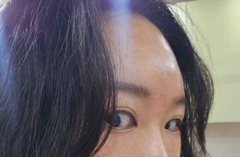 비앤비성형외과 이미지