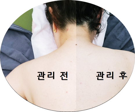 고아라스킨케어 이미지