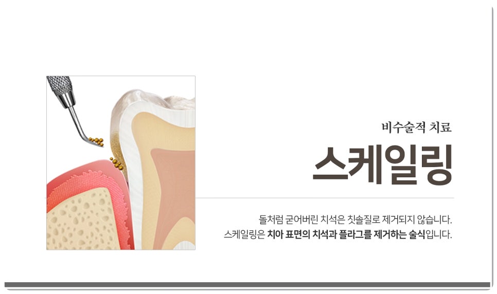 후전자담배 이미지