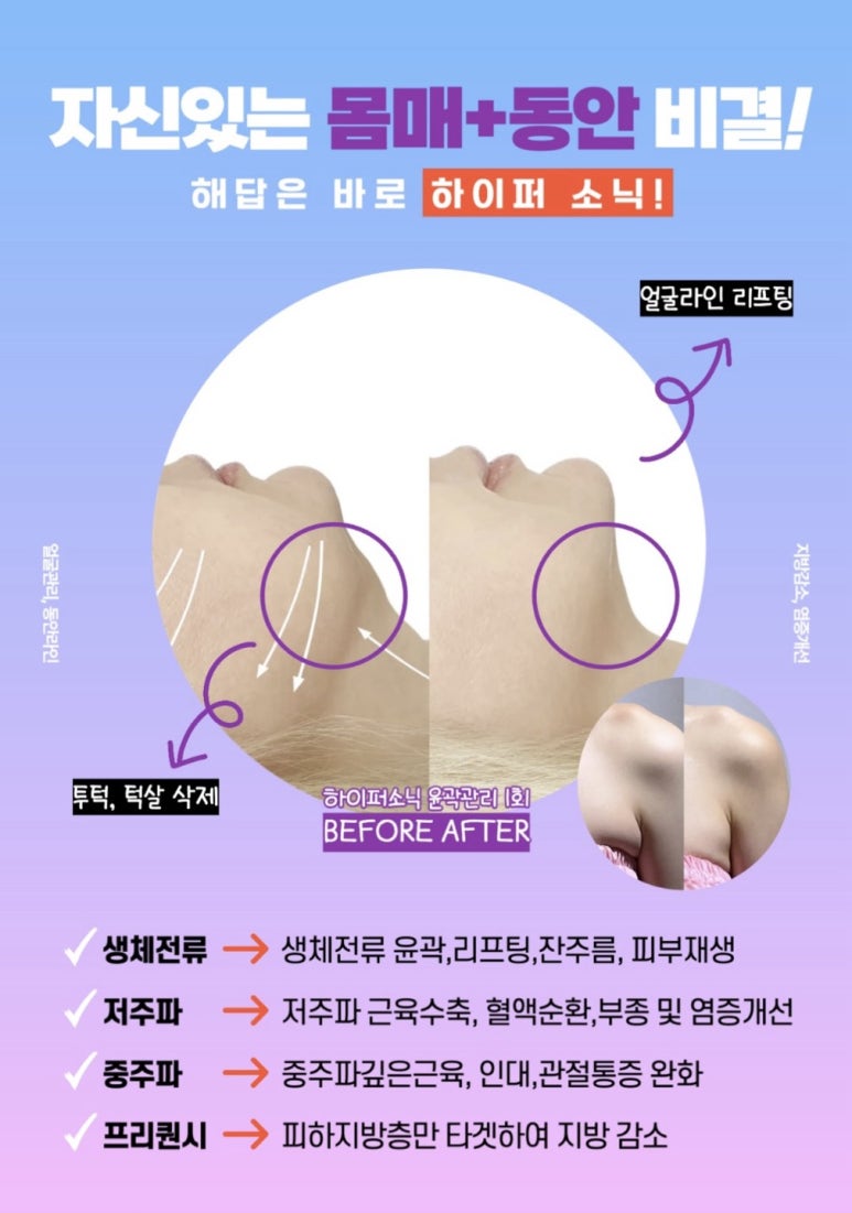 세라에너지 이미지