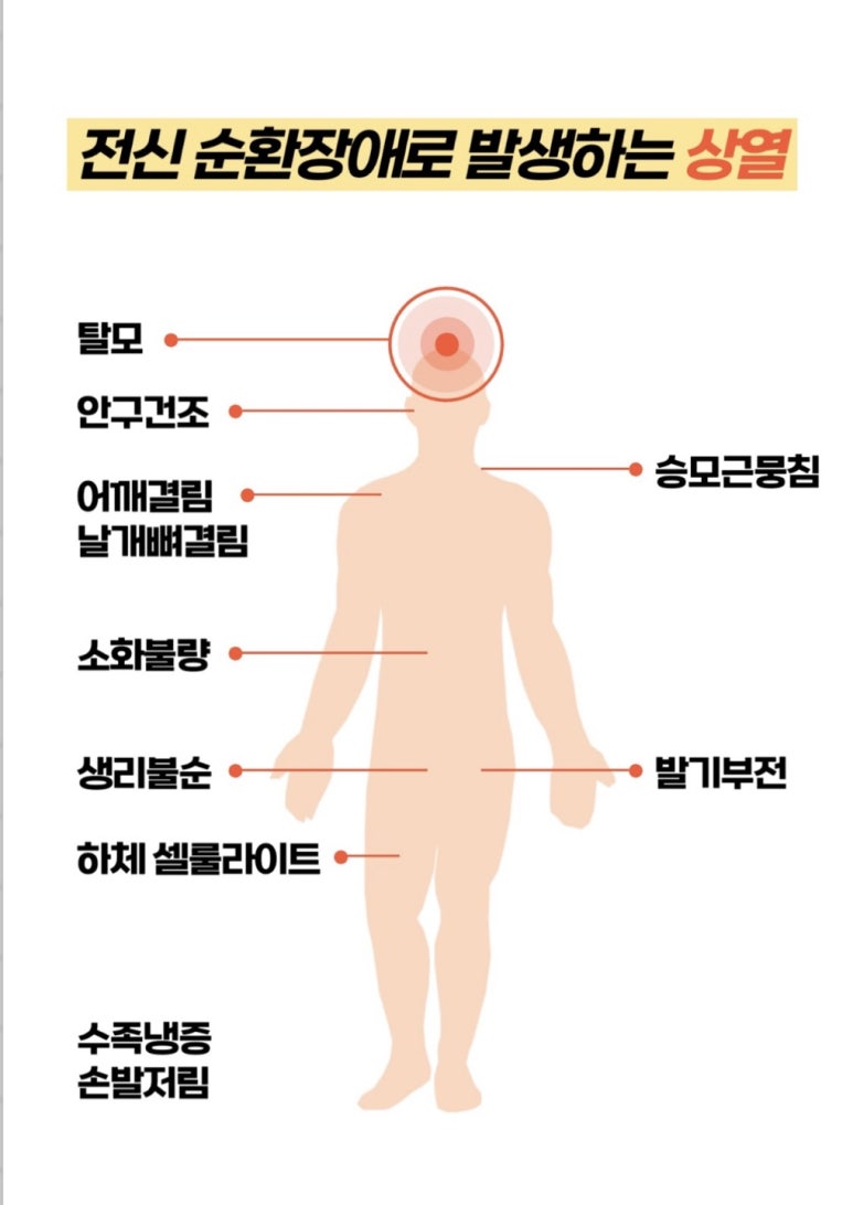 세라에너지 이미지