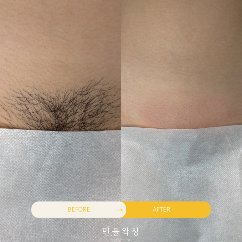 민들왁싱 이미지