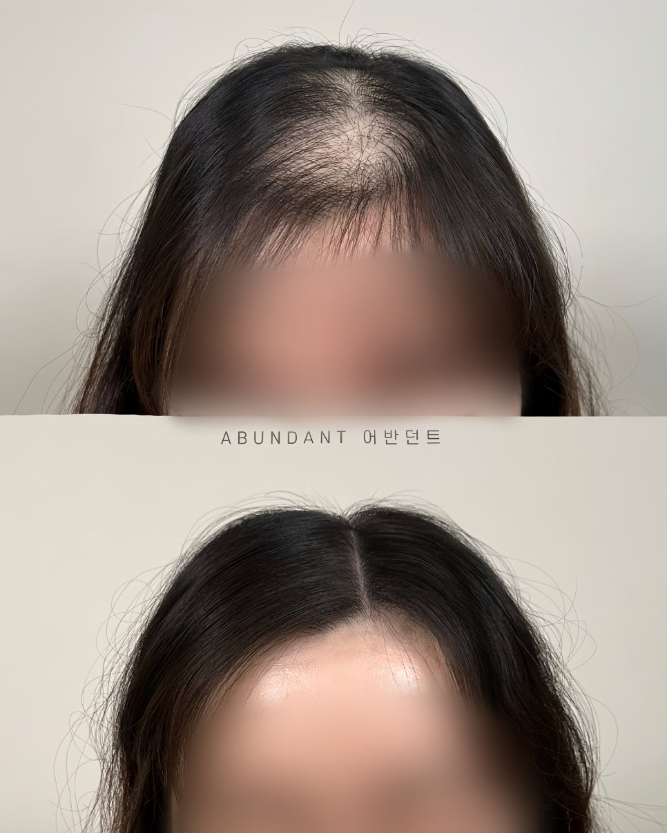 어반던트 이미지