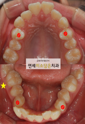 연세미소담은치과 이미지