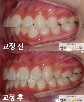 연세미소담은치과 이미지
