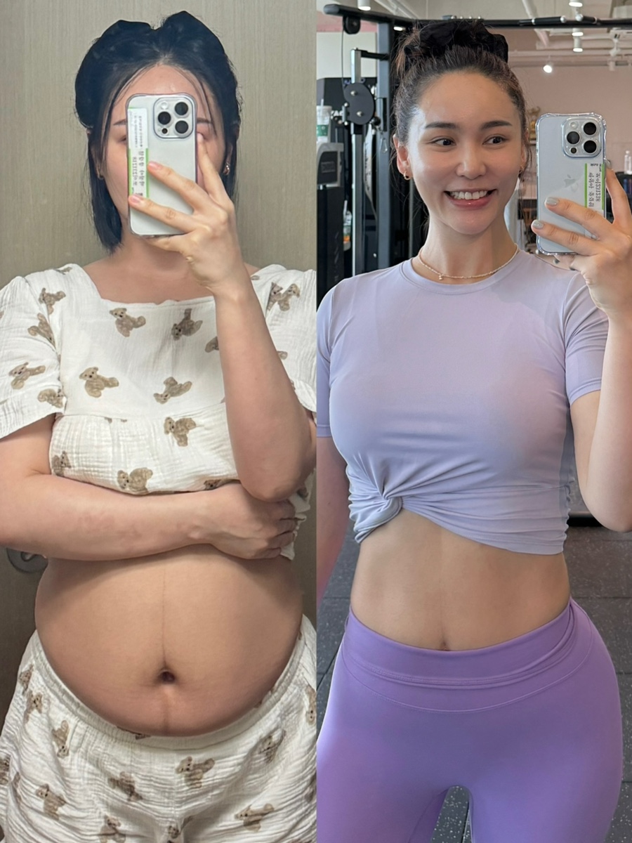 미드미짐 이미지