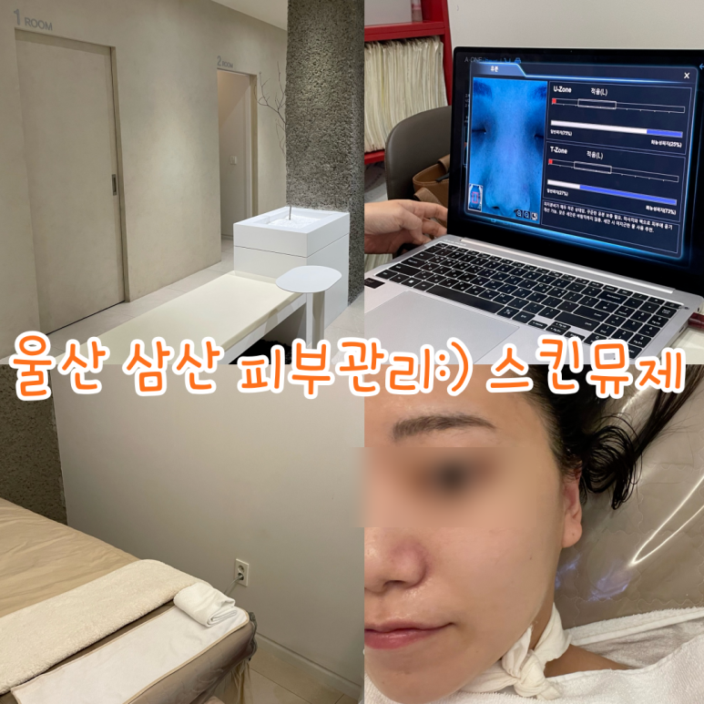 스킨뮤제 이미지
