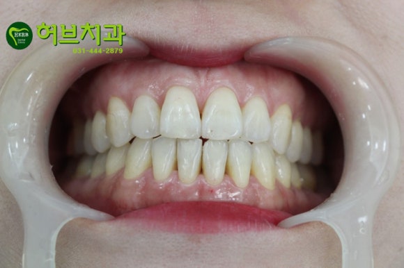 허브치과 이미지