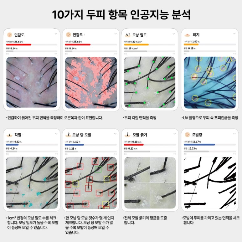두피·탈모태후사랑하남점 이미지