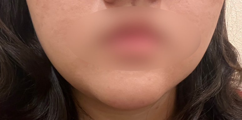 고릴라치과의원 이미지