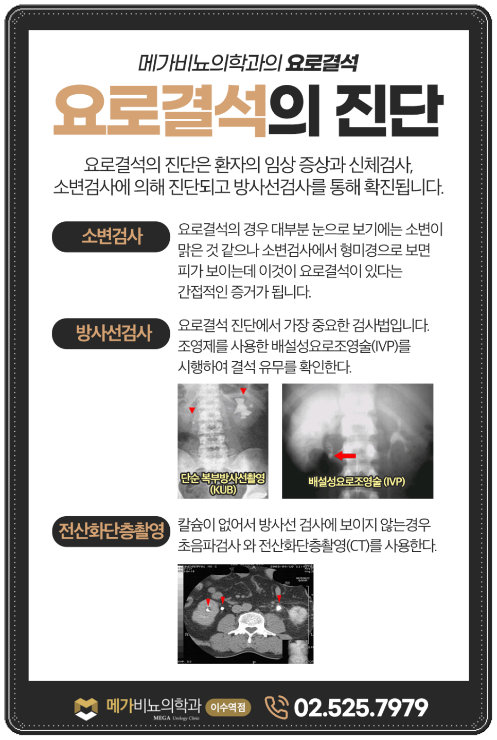 메가비뇨의학과 이미지