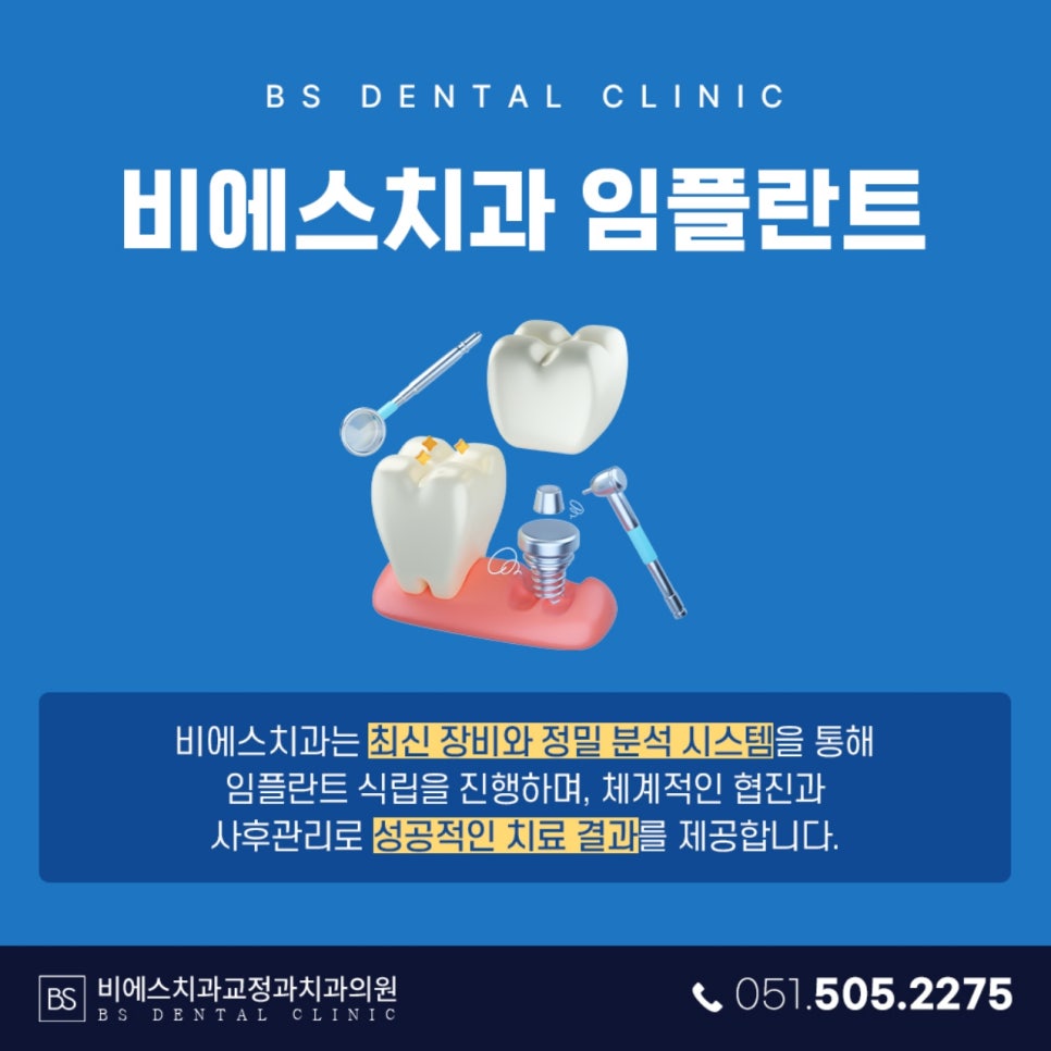 비에스브릿지 이미지