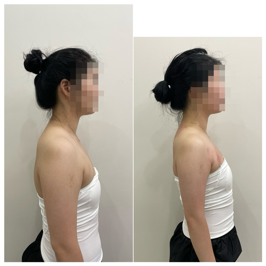 메이약손테라피 이미지