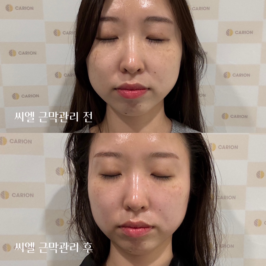 카리언 뷰티 클리닉 이미지