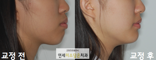 연세미소담은치과 이미지